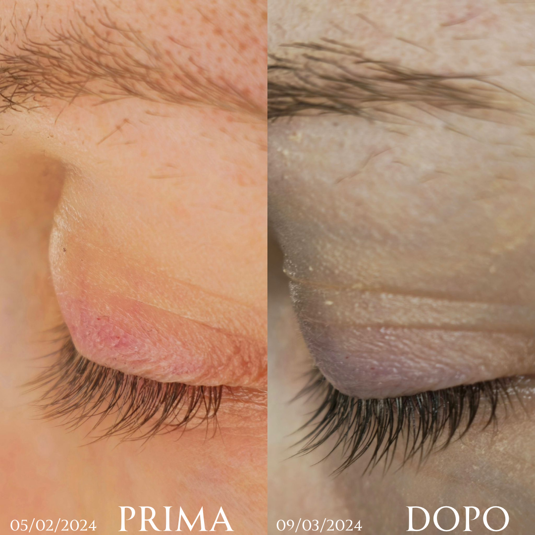 Siero intensivo ciglia (10ml) - ElumiSkin