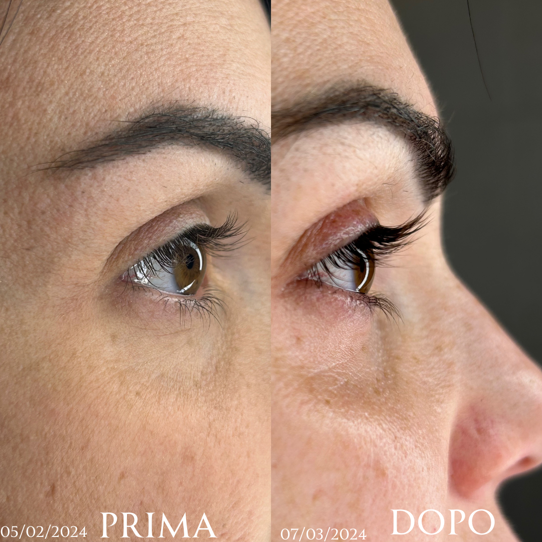 Siero intensivo ciglia (10ml) - ElumiSkin